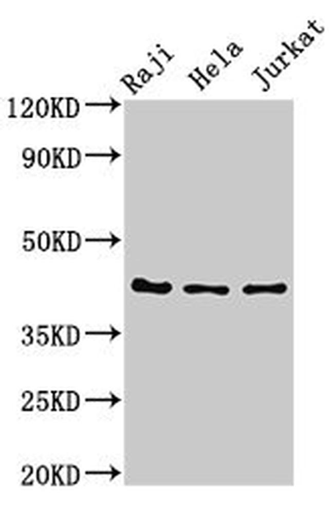 PAG1B Antibody in Western Blot (WB)