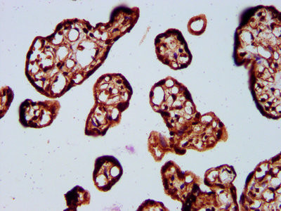 SOS1 Antibody in Immunohistochemistry (Paraffin) (IHC (P))