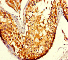 ADCK2 Antibody in Immunohistochemistry (Paraffin) (IHC (P))