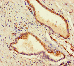 ADCK2 Antibody in Immunohistochemistry (Paraffin) (IHC (P))