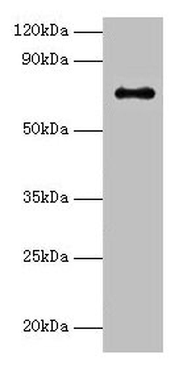 ADCK2 Antibody in Western Blot (WB)