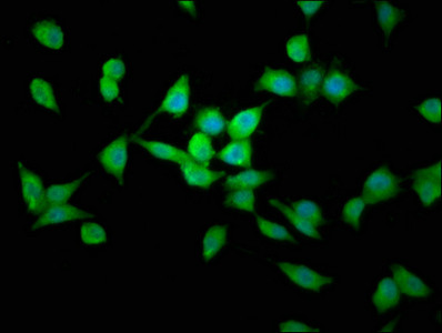 LAPTM4B Antibody in Immunocytochemistry (ICC/IF)