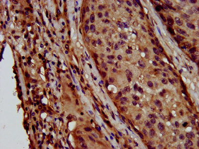 LAPTM4B Antibody in Immunohistochemistry (Paraffin) (IHC (P))