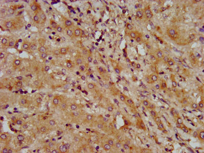 LAPTM4B Antibody in Immunohistochemistry (Paraffin) (IHC (P))