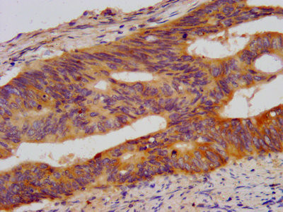 WDR37 Antibody in Immunohistochemistry (Paraffin) (IHC (P))