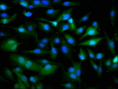 Pannexin 1 Antibody in Immunocytochemistry (ICC/IF)