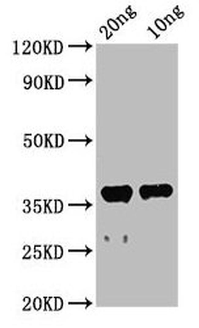 Acetylcholinesterase Antibody in Western Blot (WB)