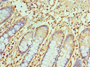 TREX1 Antibody in Immunohistochemistry (Paraffin) (IHC (P))