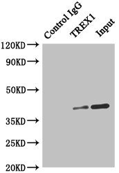 TREX1 Antibody in Immunoprecipitation (IP)