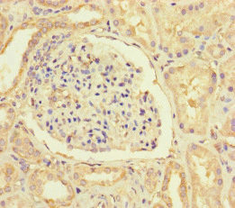 HIF1AN Antibody in Immunohistochemistry (Paraffin) (IHC (P))