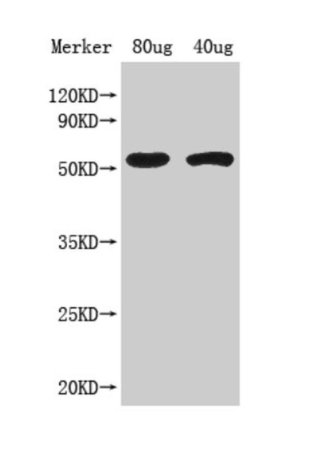 Arabidopsis thaliana ACS8 Antibody in Western Blot (WB)