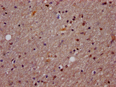 AGO2 Antibody in Immunohistochemistry (Paraffin) (IHC (P))