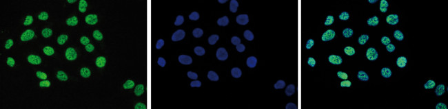 H3K9ac Antibody in Immunocytochemistry (ICC/IF)