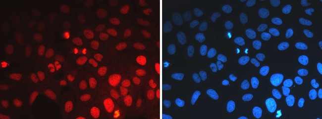 H3K36me1 Antibody in Immunocytochemistry (ICC/IF)