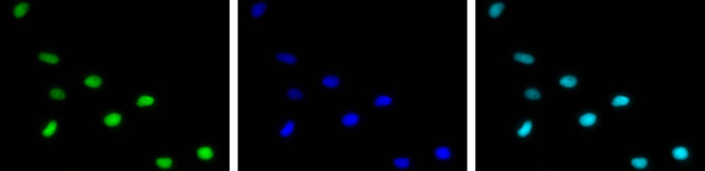 H4K12ac Antibody in Immunocytochemistry (ICC/IF)