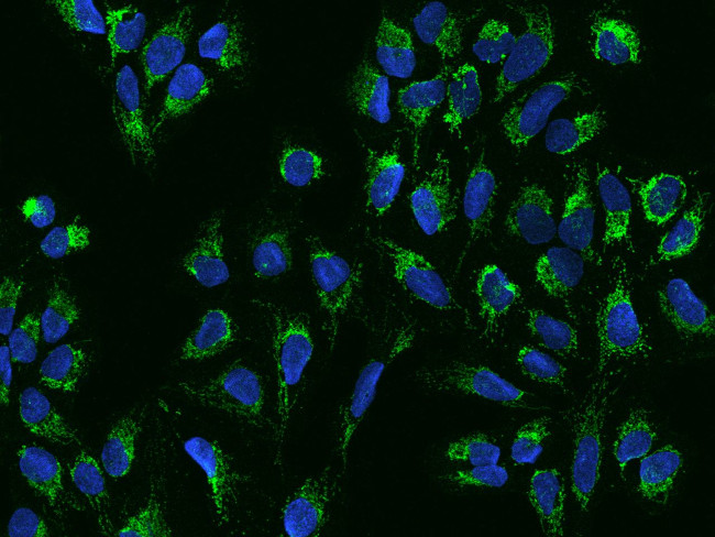 ACOT1 Antibody in Immunocytochemistry (ICC/IF)