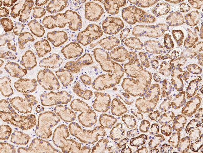 ACOT1 Antibody in Immunohistochemistry (Paraffin) (IHC (P))