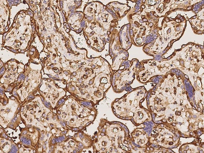 alpha Actinin 4 Antibody in Immunohistochemistry (Paraffin) (IHC (P))