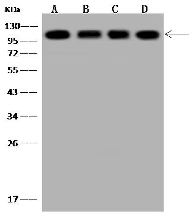 alpha Actinin 4 Antibody in Western Blot (WB)