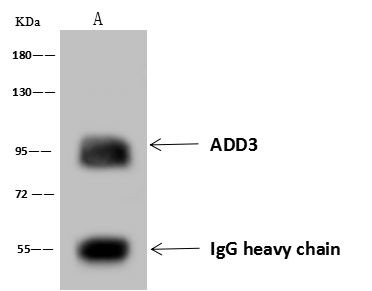 GADD34 Antibody in Immunoprecipitation (IP)