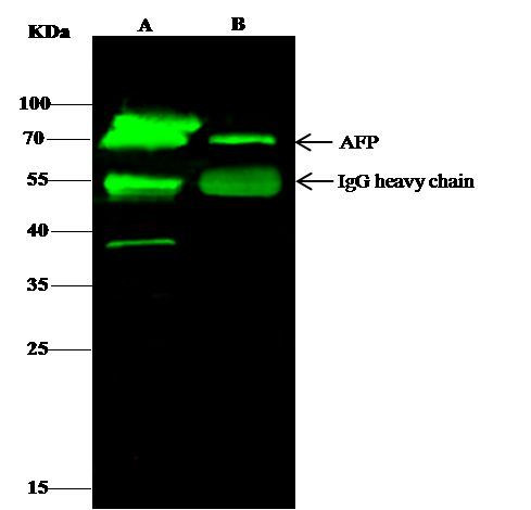 AFP Antibody in Immunoprecipitation (IP)