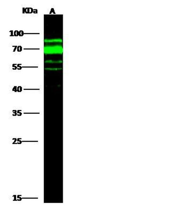 AFP Antibody in Western Blot (WB)