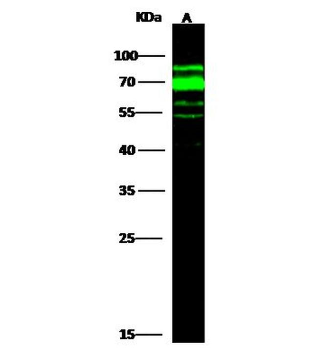 AFP Antibody in Western Blot (WB)