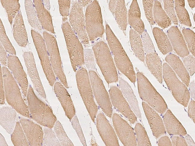 AGTPBP1 Antibody in Immunohistochemistry (Paraffin) (IHC (P))