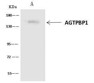 AGTPBP1 Antibody in Immunoprecipitation (IP)