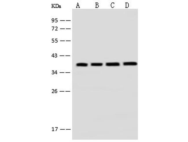 EMAP II Antibody in Western Blot (WB)