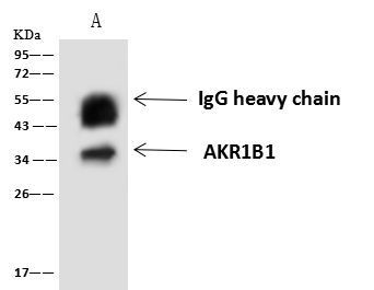 AKR1B1 Antibody in Immunoprecipitation (IP)