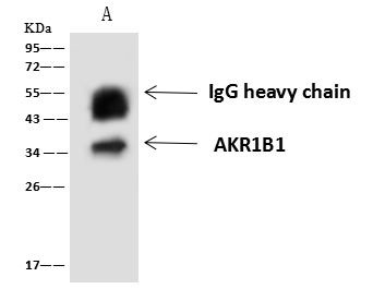 AKR1B1 Antibody in Immunoprecipitation (IP)