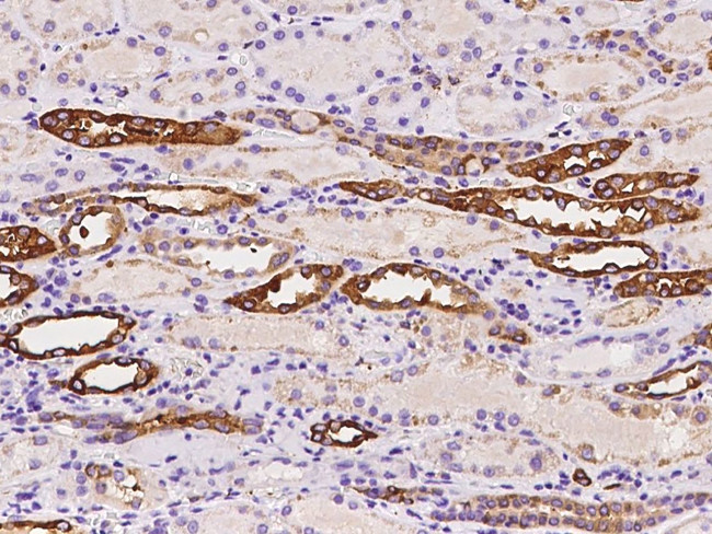 ALDH1A2 Antibody in Immunohistochemistry (Paraffin) (IHC (P))