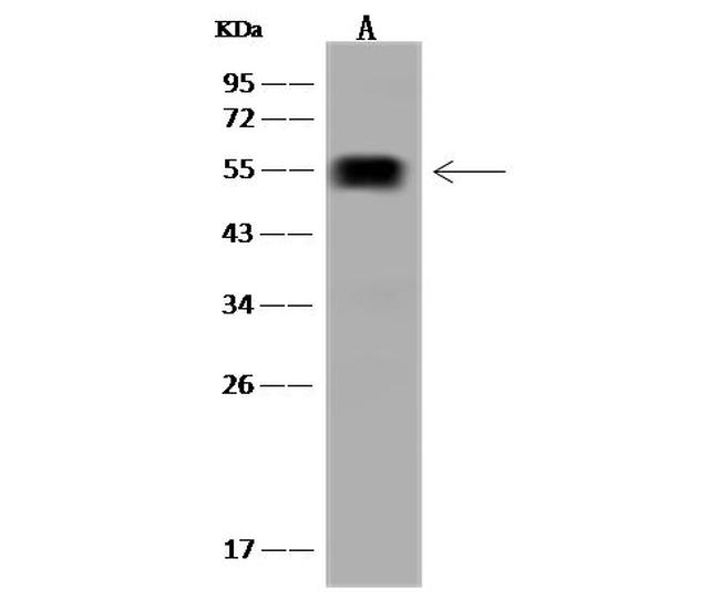 ALDH1A2 Antibody in Western Blot (WB)