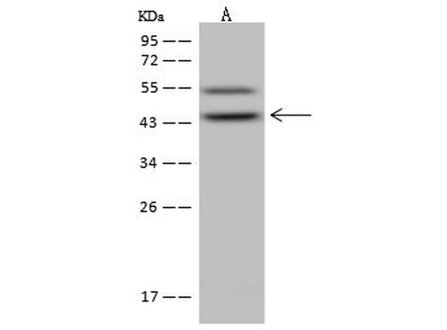 ABH1 Antibody in Western Blot (WB)