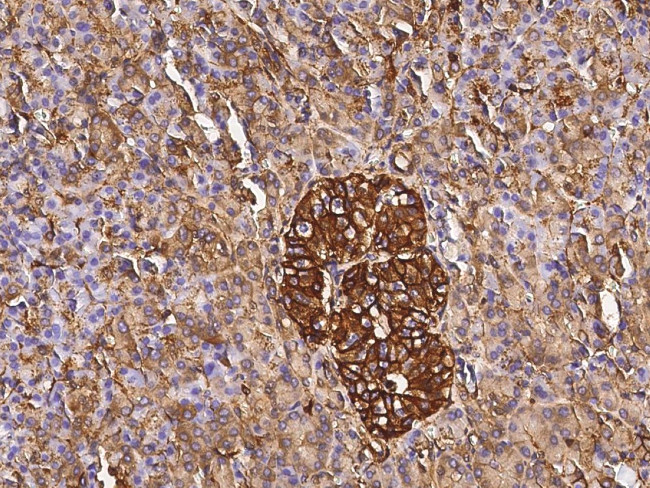 Annexin A6 Antibody in Immunohistochemistry (Paraffin) (IHC (P))