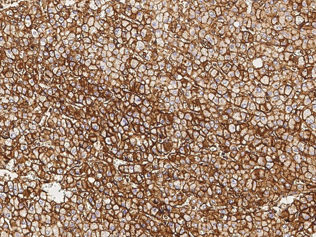 Annexin A6 Antibody in Immunohistochemistry (Paraffin) (IHC (P))