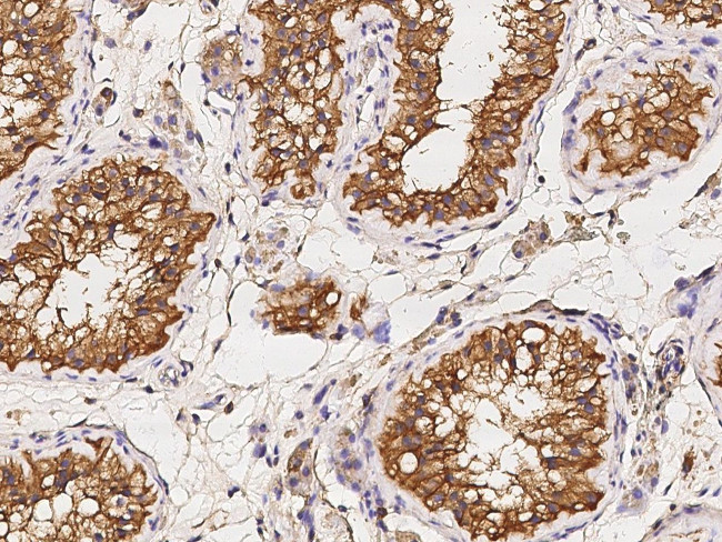 Annexin A6 Antibody in Immunohistochemistry (Paraffin) (IHC (P))