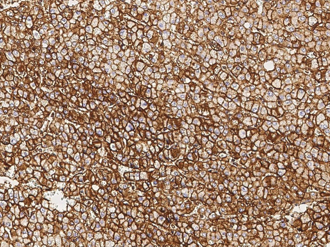 Annexin A6 Antibody in Immunohistochemistry (Paraffin) (IHC (P))