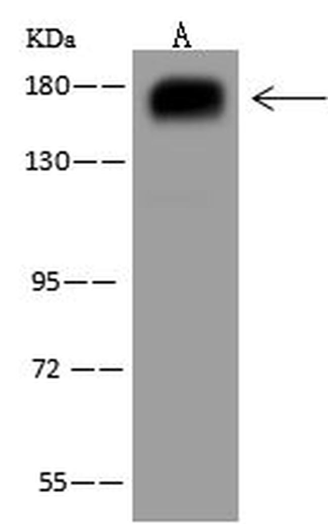 PARG1 Antibody in Western Blot (WB)