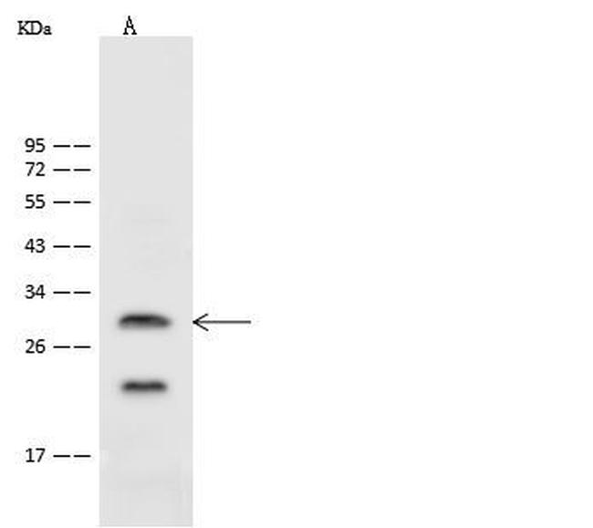 ASCL1 Antibody in Western Blot (WB)