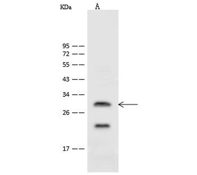 ASCL1 Antibody in Western Blot (WB)