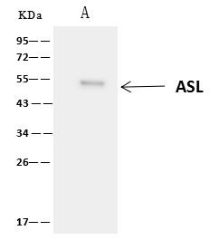 ASL Antibody in Immunoprecipitation (IP)
