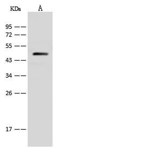 V-ATPase C1 Antibody in Western Blot (WB)