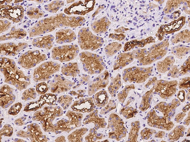 ATP6V1E1 Antibody in Immunohistochemistry (Paraffin) (IHC (P))