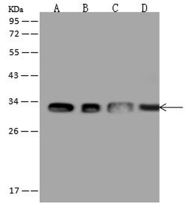 ATP6V1E1 Antibody in Western Blot (WB)