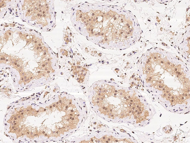 Ataxin 3 Antibody in Immunohistochemistry (Paraffin) (IHC (P))