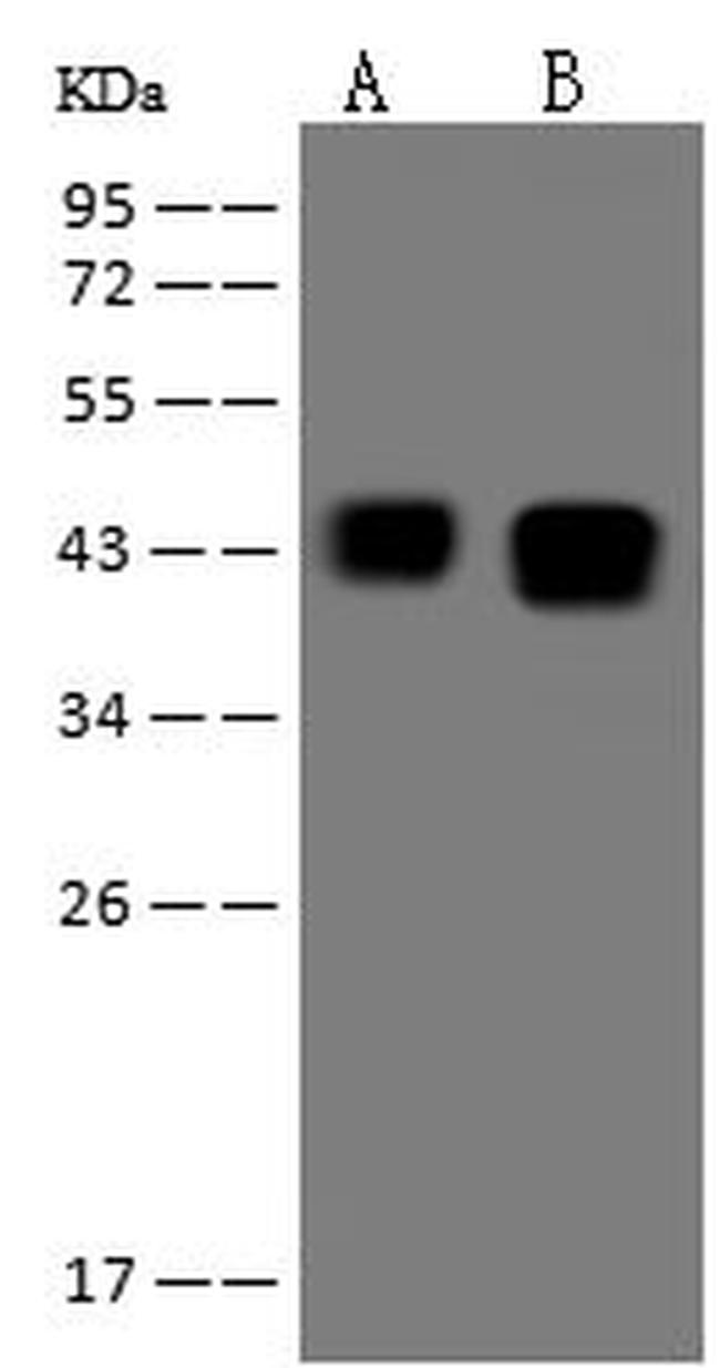 Ataxin 3 Antibody in Western Blot (WB)