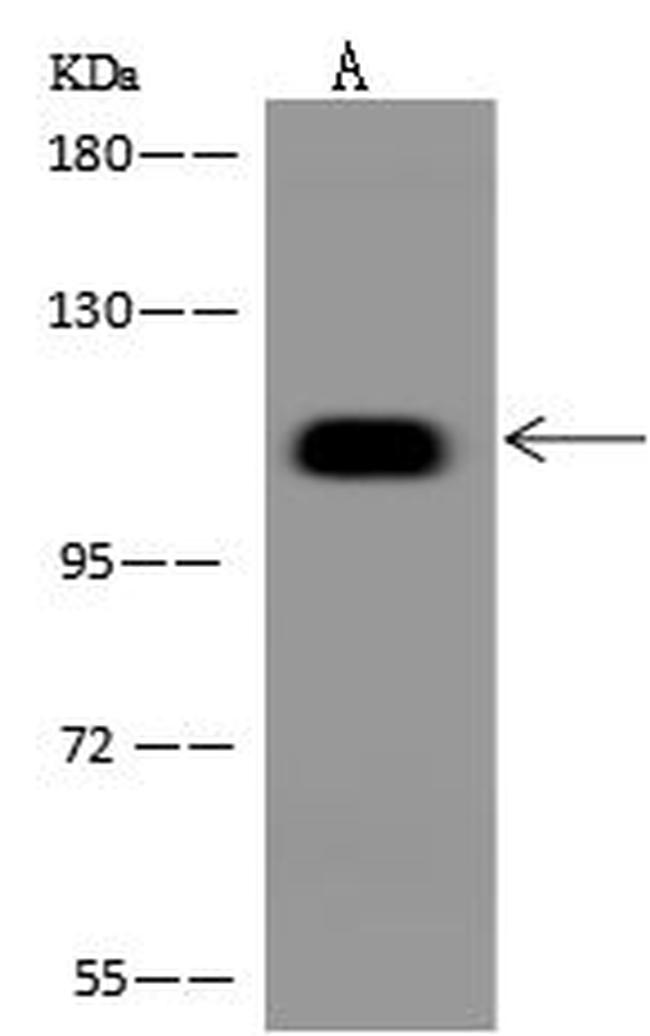 BEND3 Antibody in Western Blot (WB)