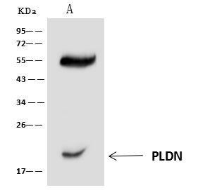 Pallidin Antibody in Immunoprecipitation (IP)